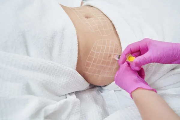 image of fat dissolving injections on love handles to help combat weight gain Kingshurst