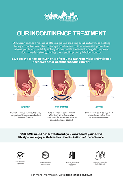 image of how urge incontinence Kingshurst treatment works